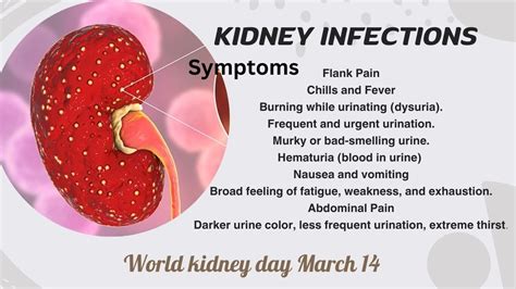 Kidney Infection : Recognizing the Signs - Symptoms and Treatment