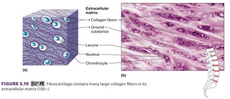 Diagramadefibrocartillatge