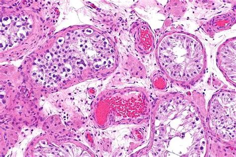 Sertoli Cells - Function, Location, Histology and Secretion