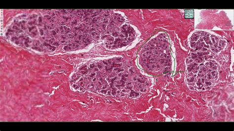 Histology of the Mammary Gland 4K - YouTube