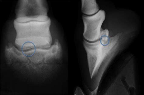 Case A case of osteochondral fragmentation of the navicular bone in a ...