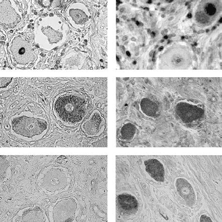 VZV vesicles: electron microscopy. | Download Scientific Diagram