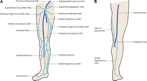 Ultrasound Evaluation of the Lower Extremity Veins - Radiologic Clinics