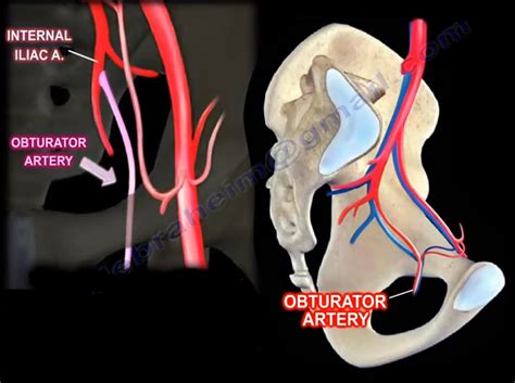 The Obturator Artery. The obturator artery is branch of the… | by Nabil Ebraheim | Medium