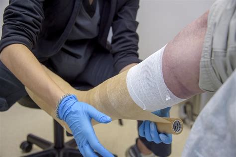 Got a Leg Wound? Could Be a Vein Problem: Vascular Solutions: Vein ...