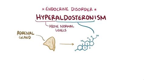 Conn Syndrome: What Is It, Causes, Symptoms, Diagnosis, Treatment, and More | Osmosis