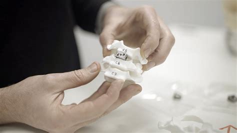 Streamlining Additive Manufacturing For Spinal Implants