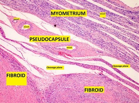 Pregnant Uterus Histology