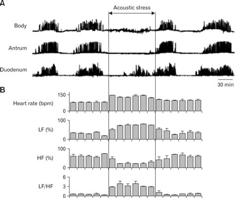 Effects of acoustic stress on gastrointestinal migrating motor complex ...