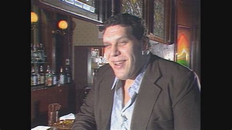 Acromegaly Andre The Giant