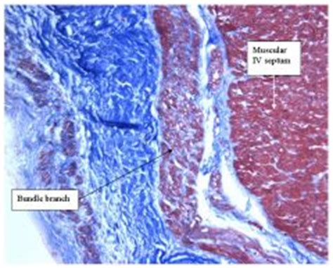 Histology - Cardiovascular System Foreign Language Flashcards - Cram.com