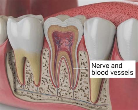 Tooth Nerve Exposed