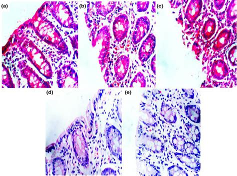 Histopathological sections of rat colon using eosin and haematoxylin... | Download Scientific ...