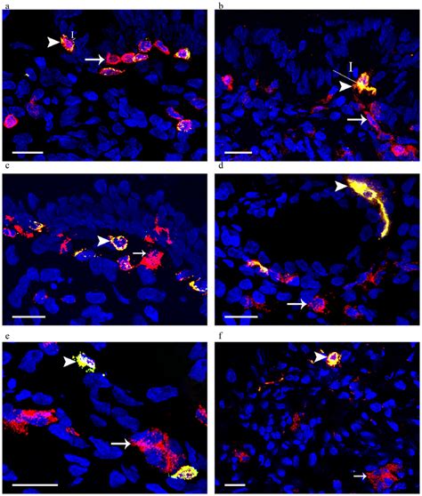 CD4 expression is present on T cells and antigen-presenting cell ...