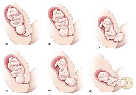 Mechanism of Labor