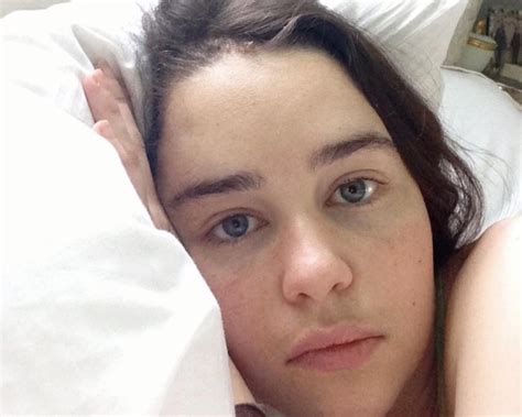 Emilia Clarke Says Part of Her Brain Died From Two Aneurysms