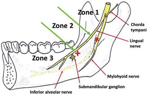 Clinical Anatomy of the lingual nerve: a review - Journal of Oral and ...