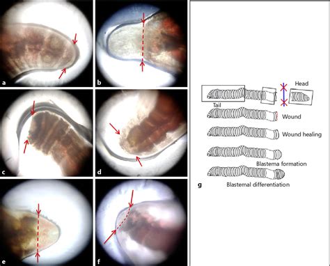 Figure 2 from Understanding the Role of the Clitellum in the Regeneration Events of the ...