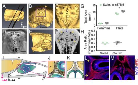 Structure of the calcified tissue of the cribriform plate and its... | Download Scientific Diagram