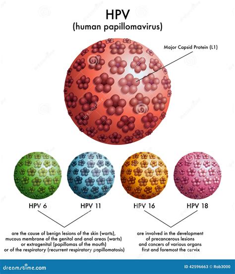 HPV (human papillomavirus) stock vector. Illustration of epidermis - 42596663