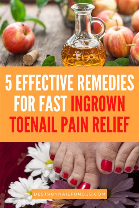 Ingrown Toenail Pain Relief Fast-Acting Solutions: The Top 5