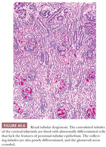 Renal Pyramid Histology