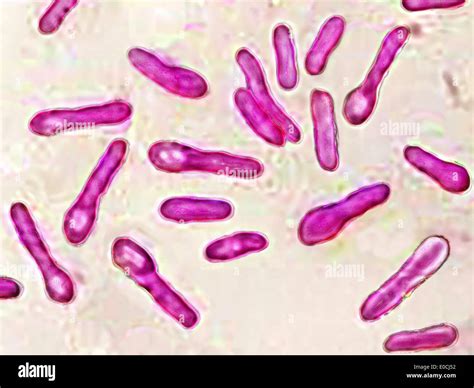 Clostridium Microscope - photos and vectors