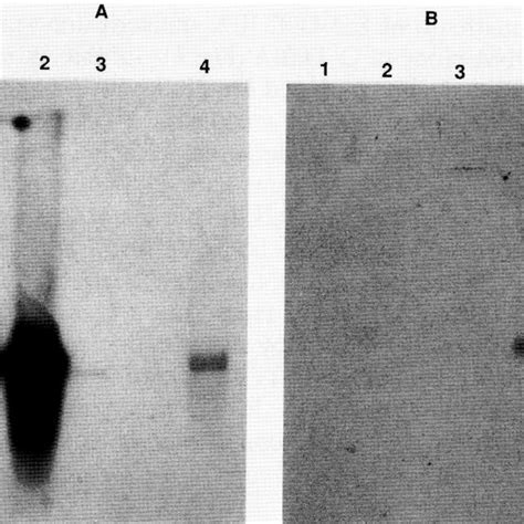 Northern blot hybridization of RNAs from the different stages of... | Download Scientific Diagram