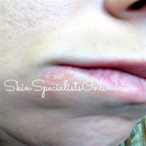 Skin Diseases Pictures and Symptoms - Skin Specialists Online