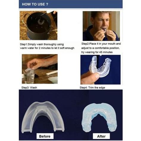 Sleep Apnea Mouthpiece - Anti Snoring Mouth Guard – DEBENHOMES