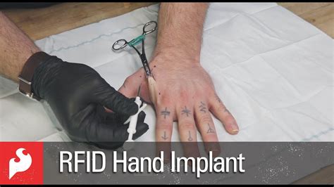 RFID Hand Implant with SparkFun! | Doovi