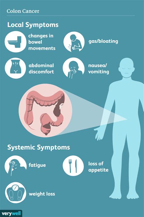 Colon Cancer: Signs, Symptoms, and Complications