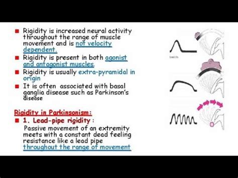 Lead pipe rigidity and cog wheeling ( neurology made easy ) - YouTube