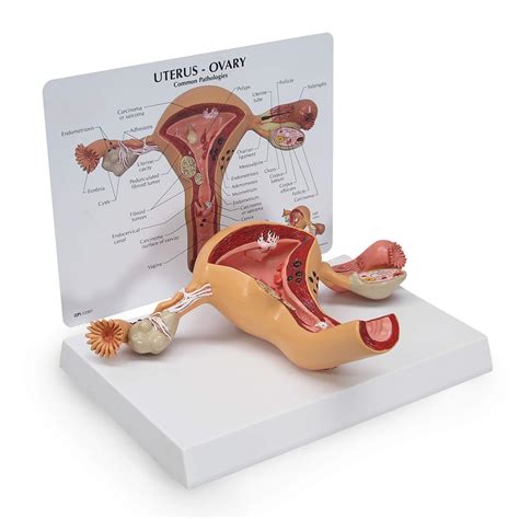 Buy Uterus and Ovary Model, Model of Female Reproductive System for Human Anatomy and Physiology ...