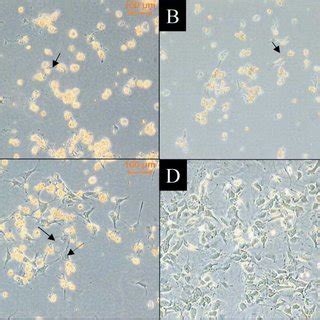 (PDF) A simple method for the simultaneous isolation of stellate cells and hepatocytes from rat ...