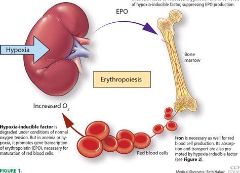 [PDF] Anemia of chronic kidney disease: Treat it, but not too aggressively | Semantic Scholar