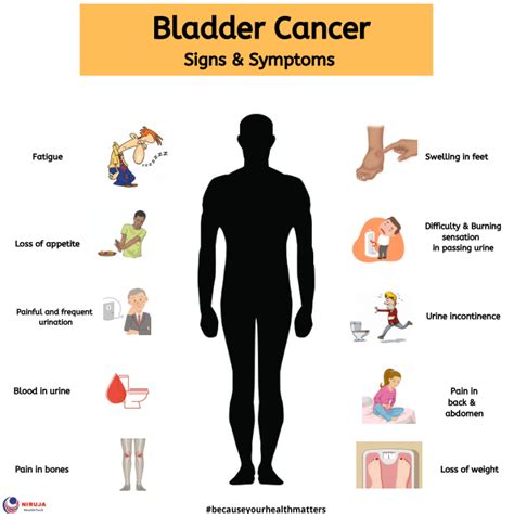 Bladder Cancer: Signs & Symptoms