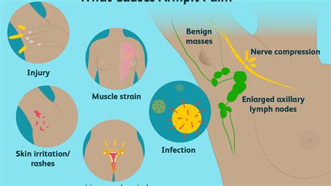 Lump in Armpit? Find Out Why Lumps Are Commonly Found in the Armpit - Sussex Air Ambulance