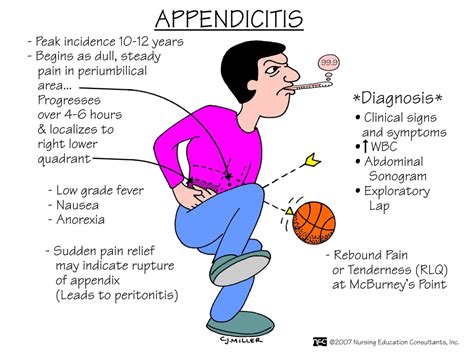 Appendicitis Diagram | Quizlet