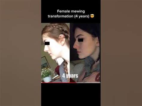 Female mewing transformation (4 years) - YouTube