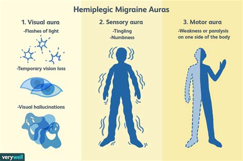 Hemiplegic Migraines: Symptoms, Causes, and Treatment