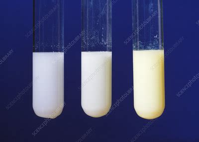 Silver compounds - Stock Image - A500/0289 - Science Photo Library