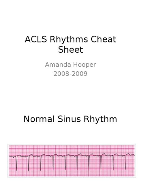 ACLS Rhythms Cheat Sheet