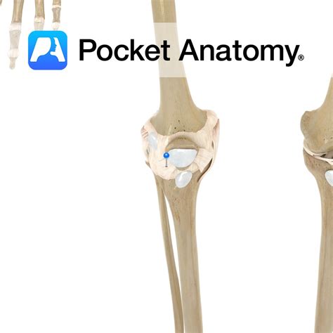 Lateral patellar ligament - Pocket Anatomy