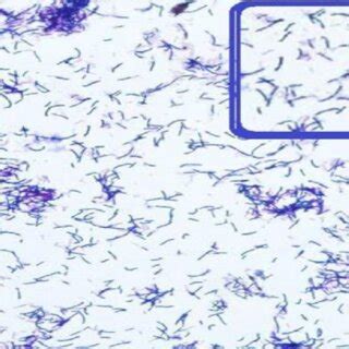 Average results of seed germination at the end of the experiment, mm ...