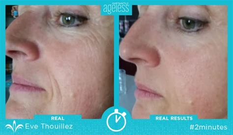 Instantly Ageless™ Before and After Photo Gallery, Jeunesse Global