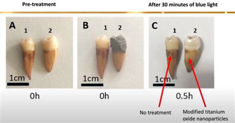 Researchers develop new coating that could remove teeth stains more effectively