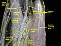 Femoral artery - Wikipedia