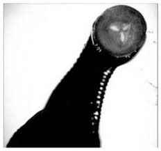 Leech Anatomy - Hirudo medicinalis