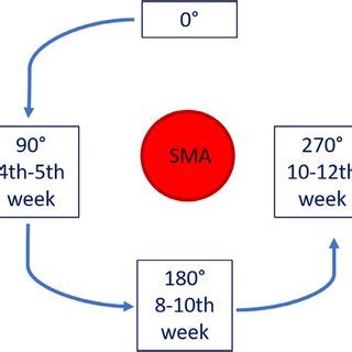 -Graphical drawing summarizing the normal steps of midgut rotation ...